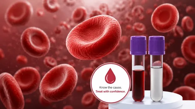 Anemia Profile